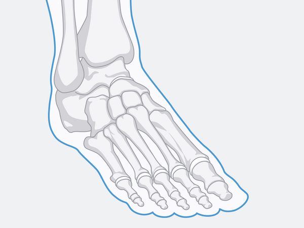 Grafik Fuß - Rheumatologie - Immanuel MVZ Barnim