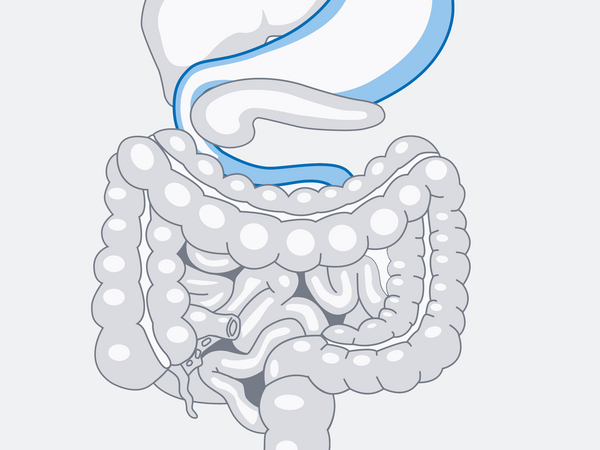 Grafik Darm - Immanuel MVZ Barnim - Gastroenterologie